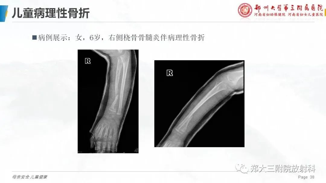 伤害宝宝骨骼的五大行为 家长自检不可忽略 (伤害宝宝骨骼的药)