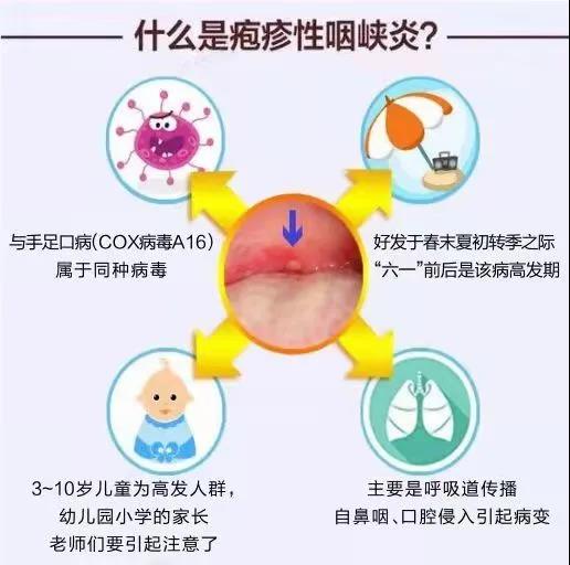 疱疹性咽峡炎传染吗