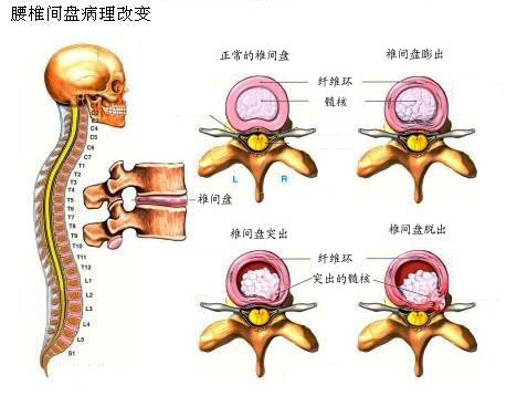 腰部