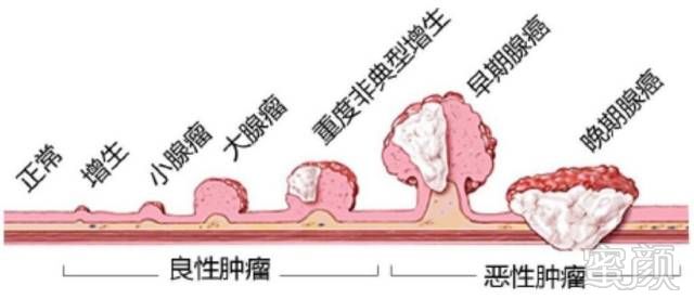 粪便