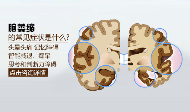 有效活跃脑细胞