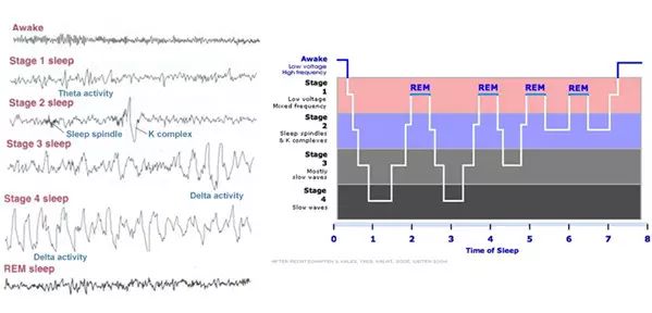 睡眠过程的三个阶段与对应的最适安眠药 不同失眠时段的安眠药选择 (睡眠过程的三个阶段)
