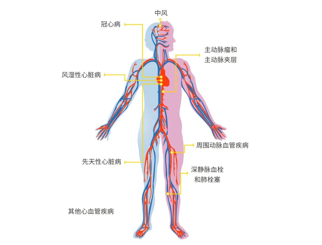 心血管疾病的主要危险因素