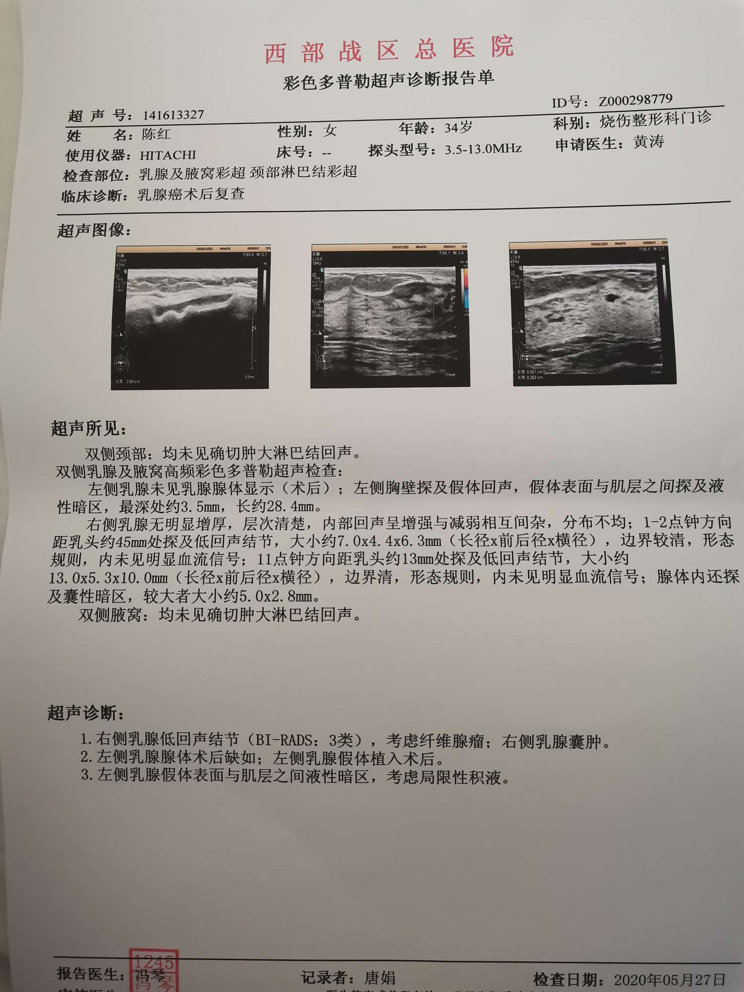 确诊为乳腺癌 36岁女子发怒后触胸发现肿块 女性情绪管理刻不容缓 (确诊为乳腺癌后治疗流程)