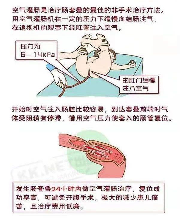 揭秘正确做法