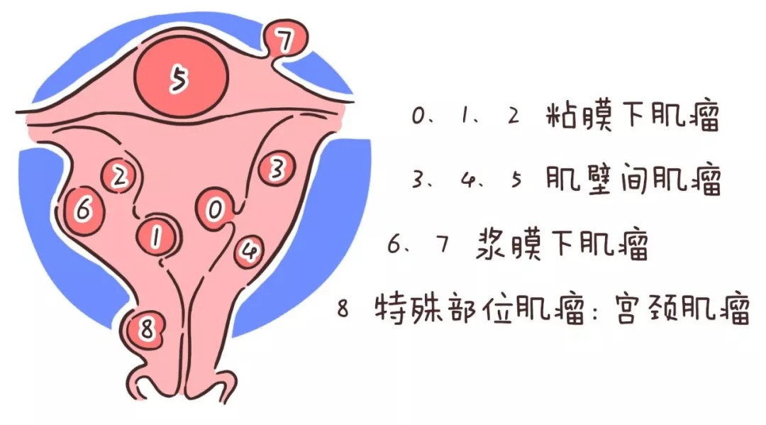 产妇