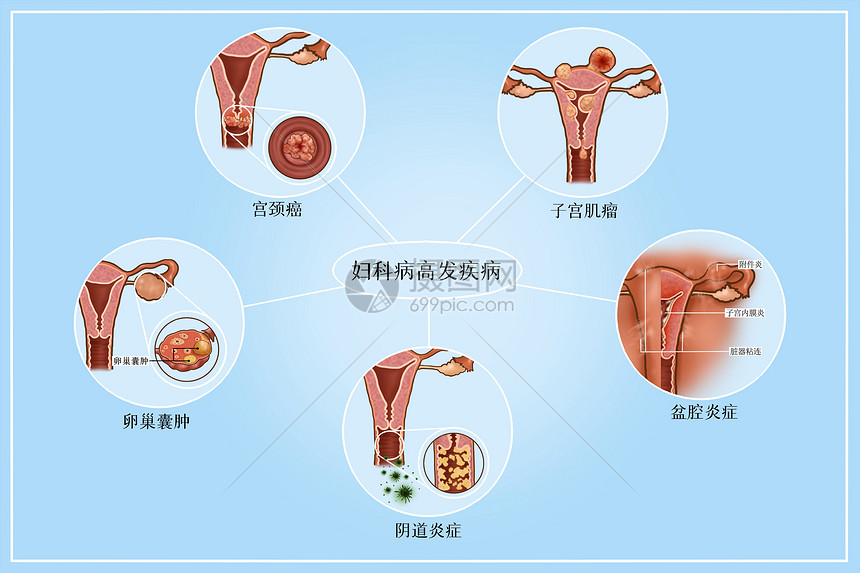 多名产妇染病 月子中心爆发诺如病毒 集体发烧 腹泻 呕吐 (多名产妇染病死亡)