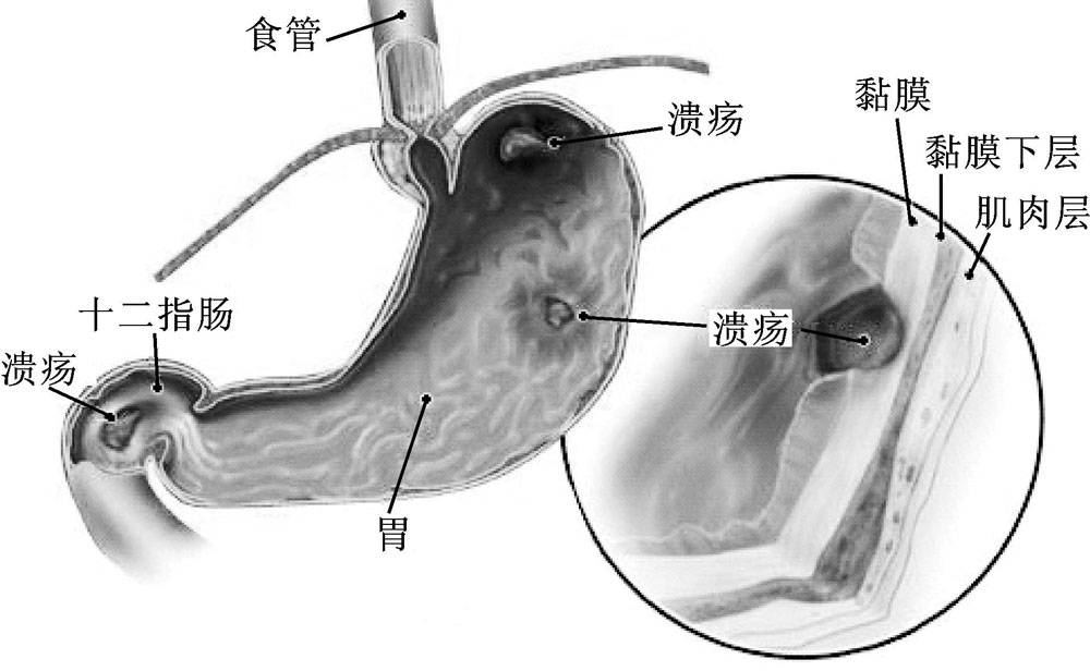 6种症状和易患揭秘